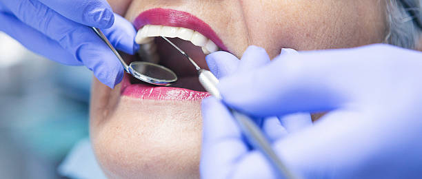 Best Emergency Broken Tooth Repair in Tamiami, FL